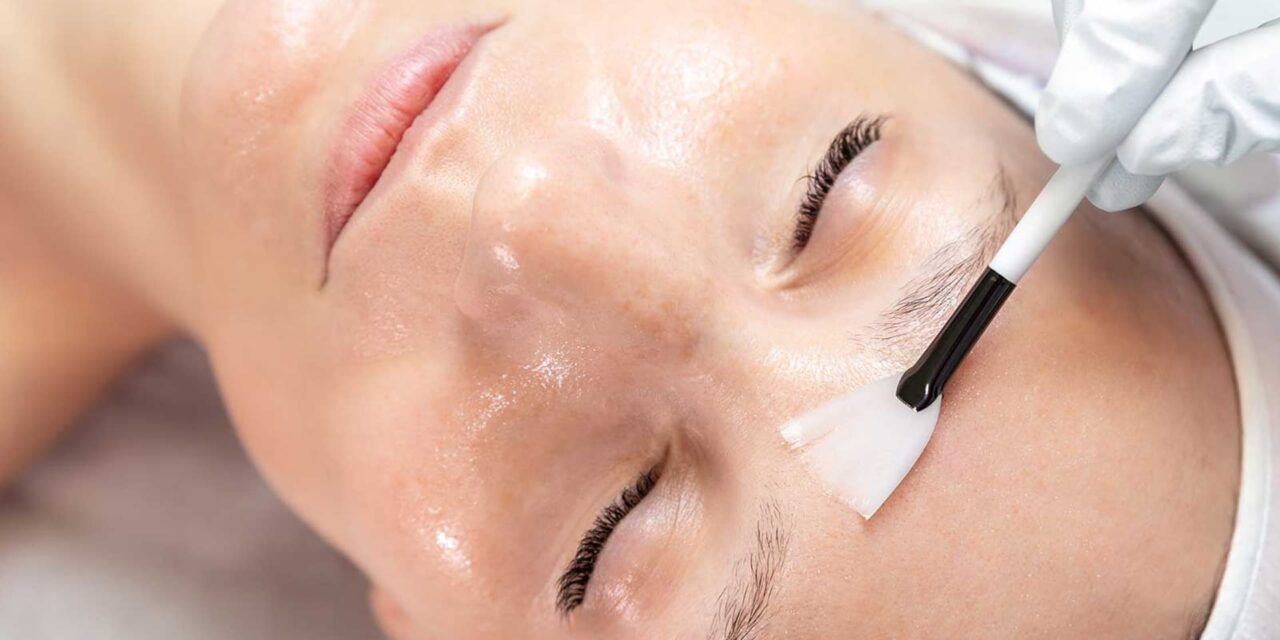 Cos’è il peeling chimico del visto?
