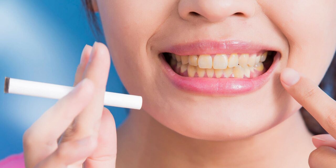 Uno stile di vita sano fa bene anche al tuo sorriso!