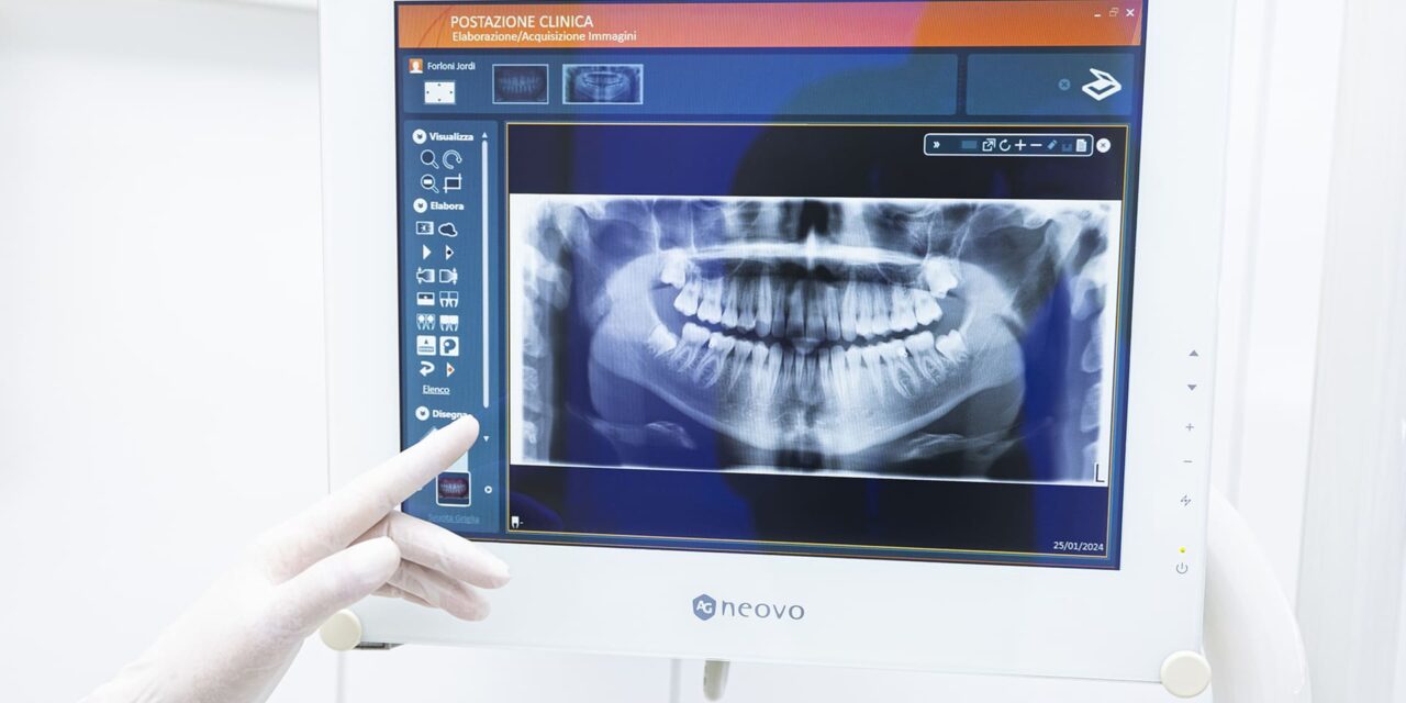 Perché è importante fare periodicamente le radiografie?